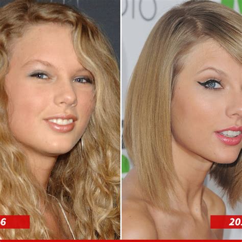 taylor swift before and after teeth